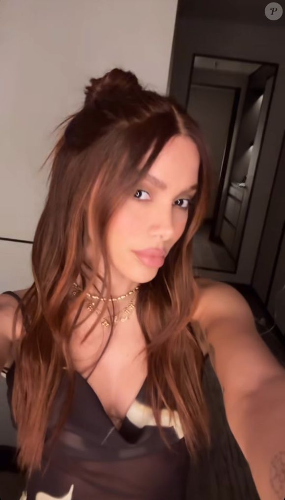 Assessoria de Anitta destacou que a cantora passou por novos procedimentos estéticos.