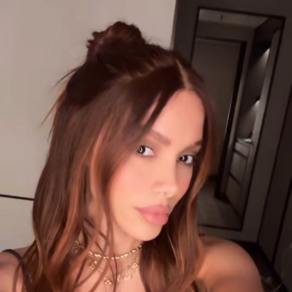 Assessoria de Anitta destacou que a cantora passou por novos procedimentos estéticos.