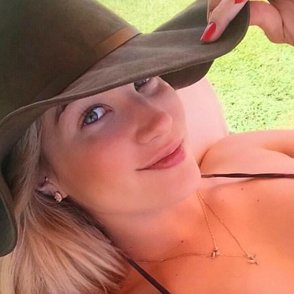 Aline Gotschalg virou influenciadora logo depois do reality show, além de também trabalhar como modelo