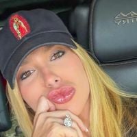 'Toda hora que eu acho que vai melhorar...': rainha de bateria da Grande Rio, Virgínia Fonseca revela problemas na pele com condição envolvendo o Carnaval