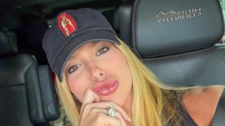 'Toda hora que eu acho que vai melhorar...': rainha de bateria da Grande Rio, Virgínia Fonseca revela problemas na pele com condição envolvendo o Carnaval