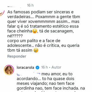 Sem papas na língua, Carolina Dieckmmann responde comentários em seu perfil, nega qualquer intervenção estética e expõe o exagero das cobranças sobre o rosto e o corpo de mulheres famosas