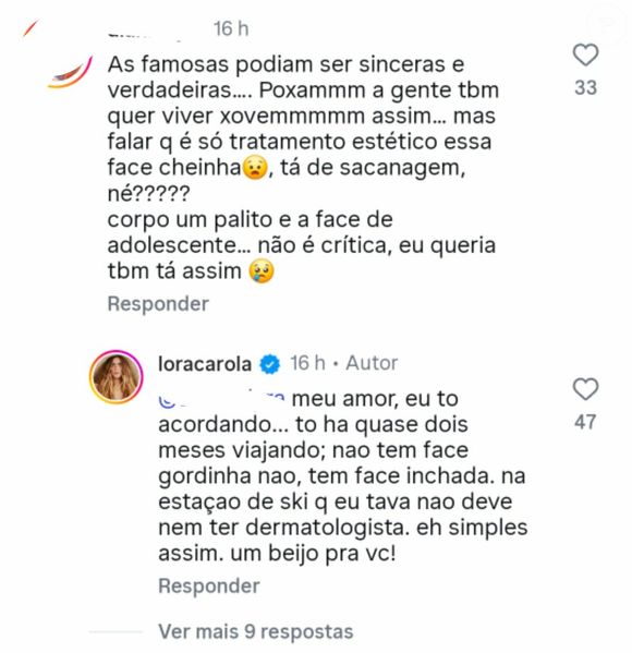 Sem papas na língua, Carolina Dieckmmann responde comentários em seu perfil, nega qualquer intervenção estética e expõe o exagero das cobranças sobre o rosto e o corpo de mulheres famosas