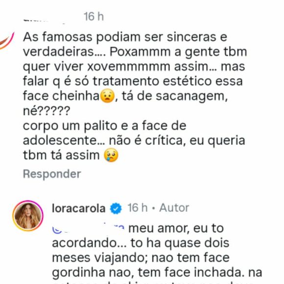 Sem papas na língua, Carolina Dieckmmann responde comentários em seu perfil, nega qualquer intervenção estética e expõe o exagero das cobranças sobre o rosto e o corpo de mulheres famosas