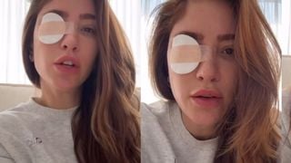 'Pior dor...': Mulher de Alok, Romana Novais faz forte alerta após lesão em procedimento estético. Entenda!