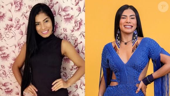 Antes e depois de Marciele: sister tem alguns procedimentos pontuais no rosto e rouba a cena por sua beleza