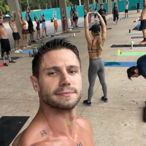 Antes do 'BBB 26', Jonas Sulzbach recorreu ao Morpheus, um procedimento que combina microagulhamento e radiofrequência