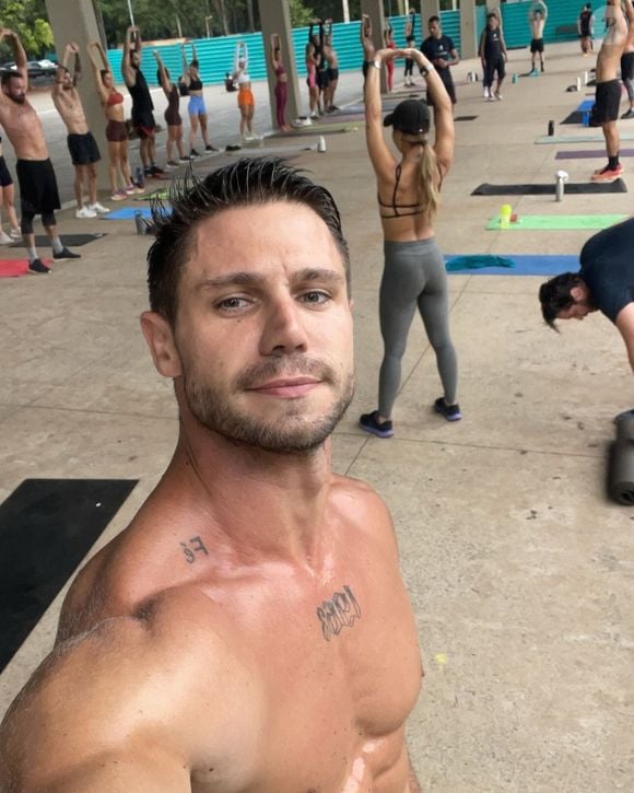 Antes do 'BBB 26', Jonas Sulzbach recorreu ao Morpheus, um procedimento que combina microagulhamento e radiofrequência