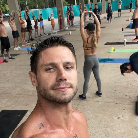 Antes do 'BBB 26', Jonas Sulzbach recorreu ao Morpheus, um procedimento que combina microagulhamento e radiofrequência