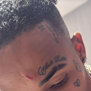 Ex-namorado de Bia Miranda, Gato Preto teve a testa cortada.r