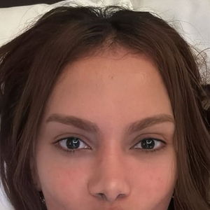 Anitta: ‘Eu sempre faço procedimentos na minha cara, gente. Desde sei lá quando. Isso é um costume’