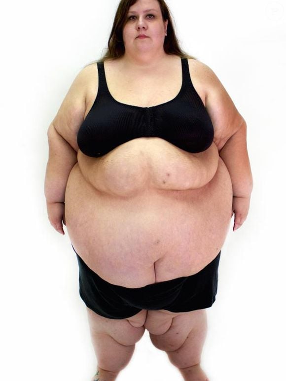 Lacey chegou ao 'Quilo Mortais' pesando 313 kg e correndo riscos de vida absurdos