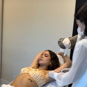 Mel Maia: a aplicação de botox é recomendado em casos de hiperidrose, que causa suor excessivo, muito além do necessário para regular a temperatura do corpo