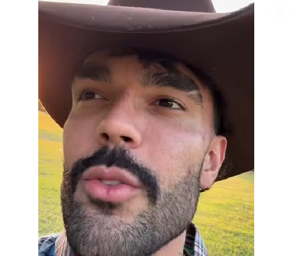 Luan Pereira apareceu com um hematoma no rosto em vídeos publicados nesta sexta-feira (22)