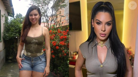 Antes e depois de Tamires Assis: ex de Davi Brito, ela só não mudou o DNA com procedimentos estéticos; hoje está irreconhecível