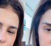 Como ficou o novo nariz de Simone Mendes? Resultado divide opiniões e cantora revela reação de Kaká Diniz: 'Ele me acha a mulher mais linda do mundo'