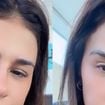 Como ficou o novo nariz de Simone Mendes? Resultado divide opiniões e cantora revela intimidade com Kaká Diniz: 'Ele me acha a mulher mais linda do mundo'