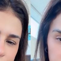Como ficou o novo nariz de Simone Mendes? Resultado divide opiniões e cantora revela intimidade com Kaká Diniz: 'Ele me acha a mulher mais linda do mundo'