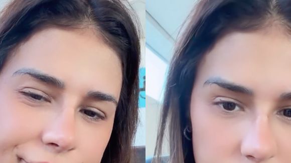 Como ficou o novo nariz de Simone Mendes? Resultado divide opiniões e cantora revela intimidade com Kaká Diniz: 'Ele me acha a mulher mais linda do mundo'