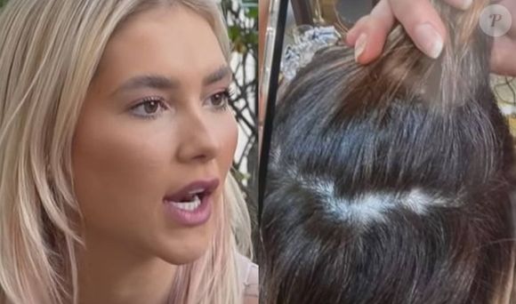 Virgínia Fonseca revela ter desenvolvido alopecia após polêmica sobre a qualidade da sua base