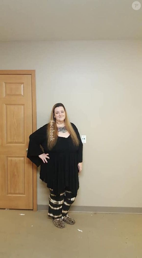 Angie J chegou a pedir a ajuda do público para pagar uma cirurgia de remoção de pele, mas não se sabe se ela a fez