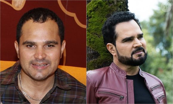 Antes e depois de Luciano Camargo: irmão de Zezé Di Camargo já passou por dois procedimentos de transplante de cabelo