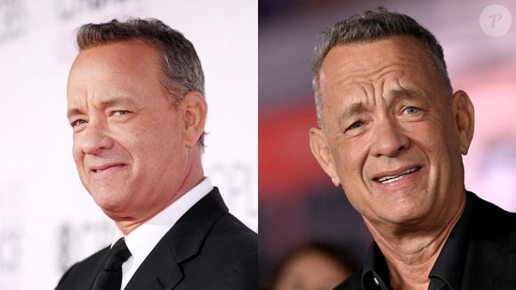 Tom Hanks é outro famoso internacional que recorreu ao transplante capilar, embora nunca tenha comentado publicamente sobre o assunto