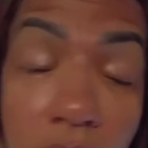 Cabeleireira de Nova Iguaçu ficou com a visão turva e embaçada após usar o fortalecedor de cílios