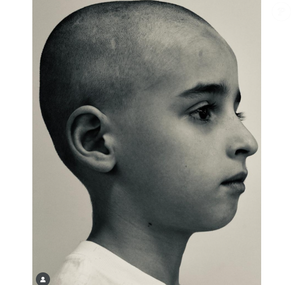 Vicent Alvite raspou os cabelos para o longa 'Festa do Peão de Barretos O Filme', estrelado por Rafael Cardoso e Marjorie Gerardi. Na história, ele vive Pedrinho, um garoto que luta contra o câncer.