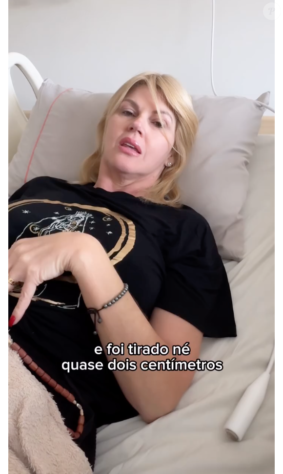 Val Marchiori retirou uma massa de quase dois centímetros do intestino por meio de uma colonoscopia na última sexta-feira (09)