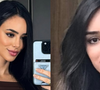 Bruna Biancardi antes e depois da rinoplastia