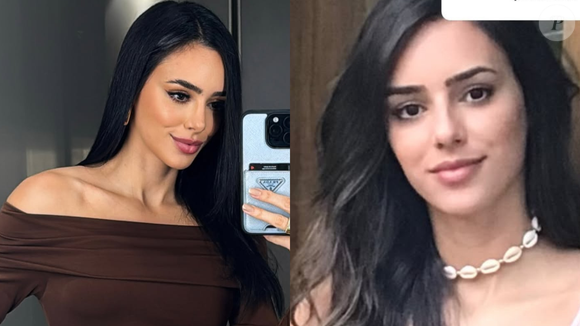 Bruna Biancardi antes e depois da rinoplastia
