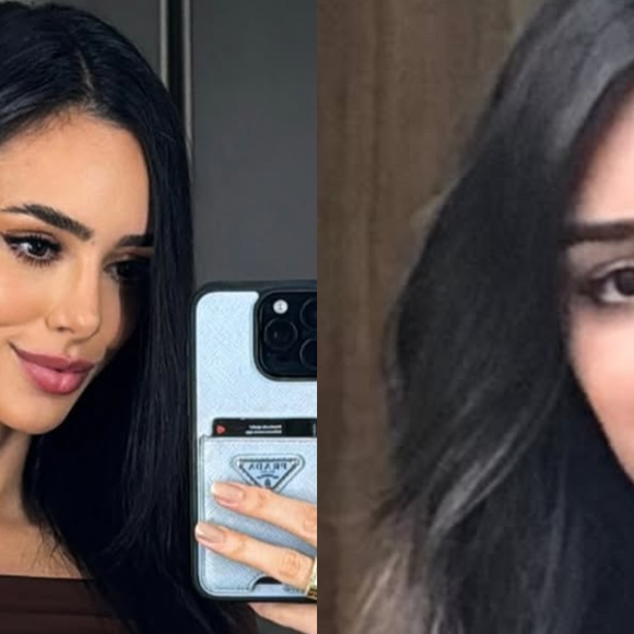 Bruna Biancardi antes e depois da rinoplastia
