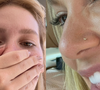 Letra 'V' de diamante no dente, homenagem a Vini Jr., risco à saúde bucal e ponto de retenção na escova: o 'tooth gem' viral de Virgínia exige acompanhamento odontológico, alerta especialista