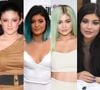 Antes e depois Kylie Jenner: em 65 fotos, veja a evolução da beleza da influencer após a fama e tudo sobre a sua jornada estética