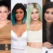Antes e depois Kylie Jenner: em 65 fotos, veja a evolução da beleza da influencer após a fama e tudo sobre a sua jornada estética