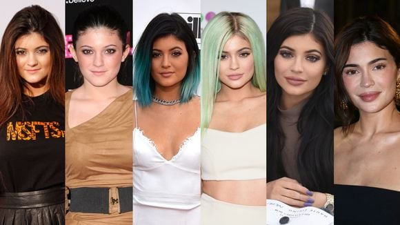 Antes e depois Kylie Jenner: em 65 fotos, veja a evolução da beleza da influencer após a fama e tudo sobre a sua jornada estética
