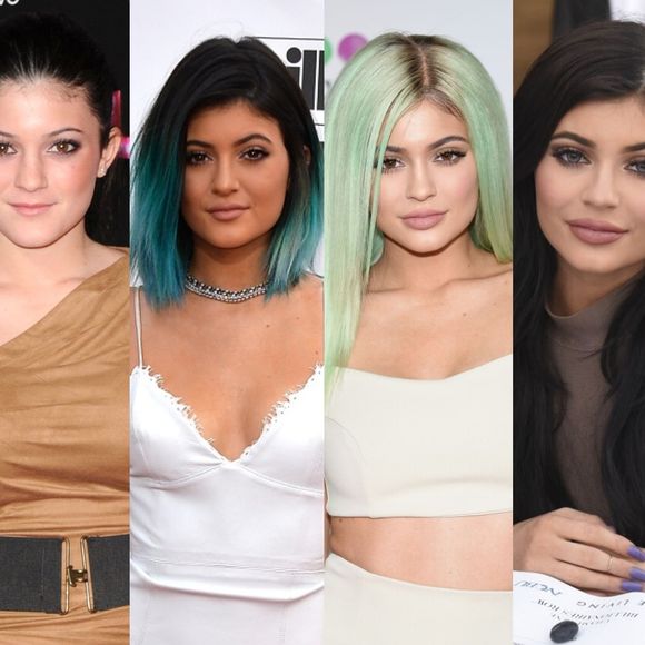 Antes e depois Kylie Jenner: em 65 fotos, veja a evolução da beleza da influencer após a fama e tudo sobre a sua jornada estética