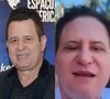 Antes e depois de Marrone: veja 28 fotos da mudança radical do cantor com harmonização facial, procedimentos e o recente acidente