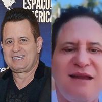 Antes e depois de Marrone: de harmonização facial ao acidente recente, 28 fotos mostram transformação polêmica do cantor em 31 anos