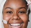 A concentração de retinol mais indicada depende, principalmente, das necessidades da pele e da tolerância de cada pessoa ao ingrediente