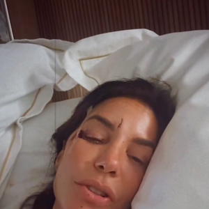 Ivete Sangalo chegou a desmaiar e feriu o rosto