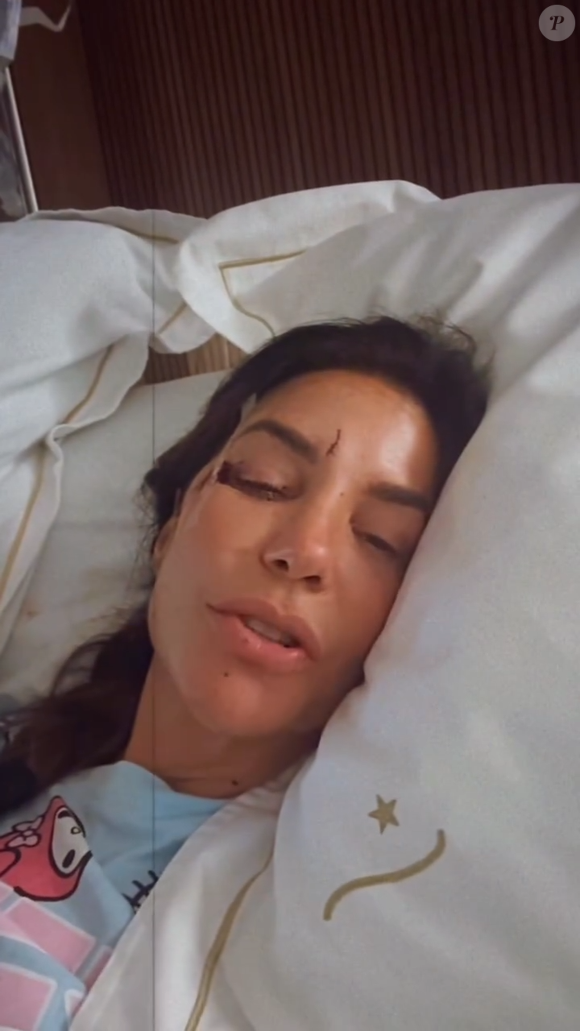 Ivete Sangalo chegou a desmaiar e feriu o rosto