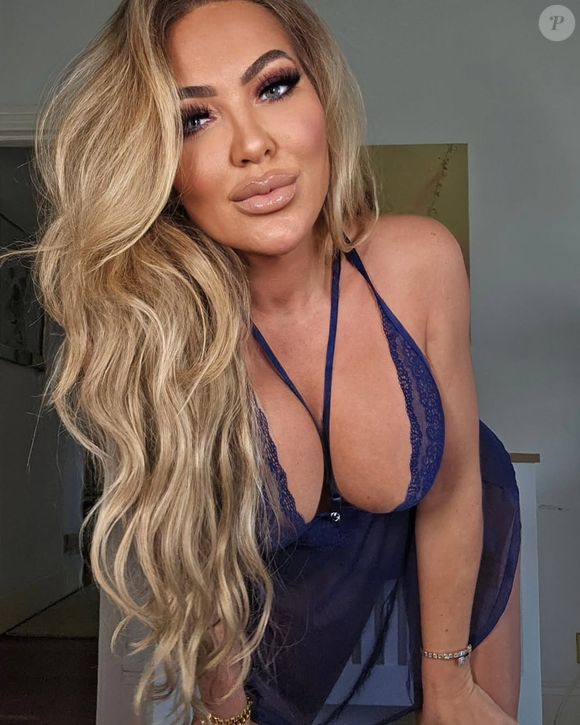 Na busca da perda dos 13 kg, a ex-BBB acabou comprando Ozempic no mercado ilegal, o que acabou detonando sua saúde