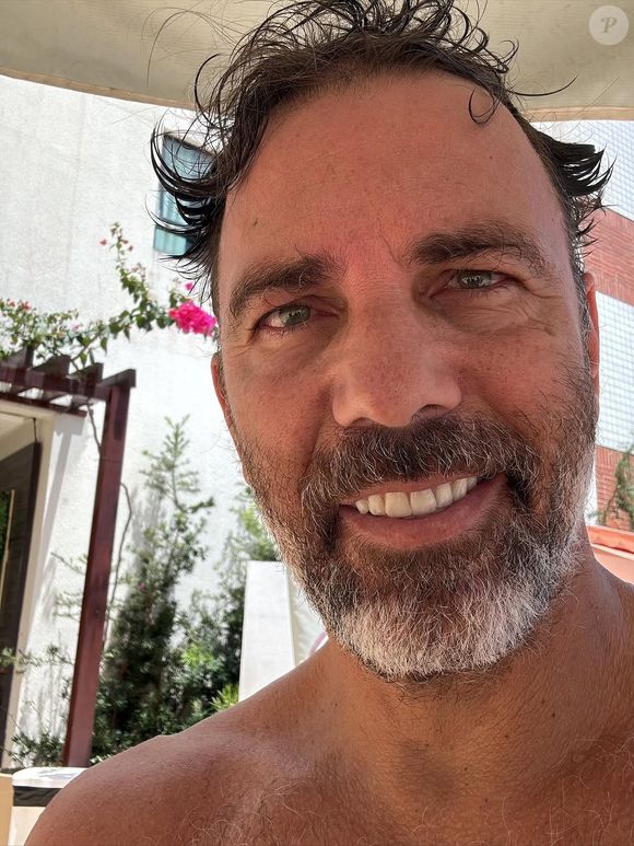 Doença de Marcelo Faria, a herpes zóster, é causada pelo vírus varicela zoster, o mesmo da catapora