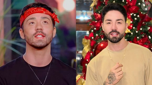 Quem mudou muito com harmonização facial foi Rico Melquíades. Na foto da esquerda, ele estava em 'A Fazenda' e já tinha uma aparência super diferente da natural