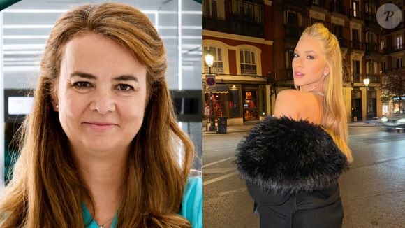 Virginia relatou sofrer com queda de cabelo