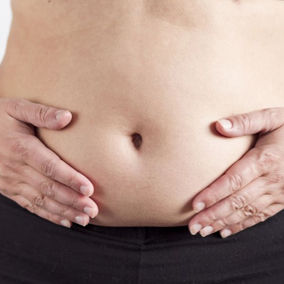 Muita gente se pergunta sobre o que é a diástase, causadora da separação dos músculos do abdômen, e isso é muito comum de acontecer após a gravidez.