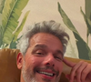 Otaviano Costa usou os Stories do Instagram para atualizar os fãs após sofrer uma lesão durante os ensaios da ‘Dança dos Famosos’