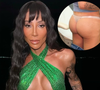 Maya Massafera decide aumentar próteses de silicone no bumbum e desiste do PMMA; veja os principais riscos!